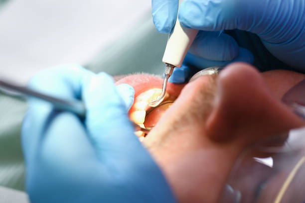 Best Emergency TMJ Treatment in Seaside, OR