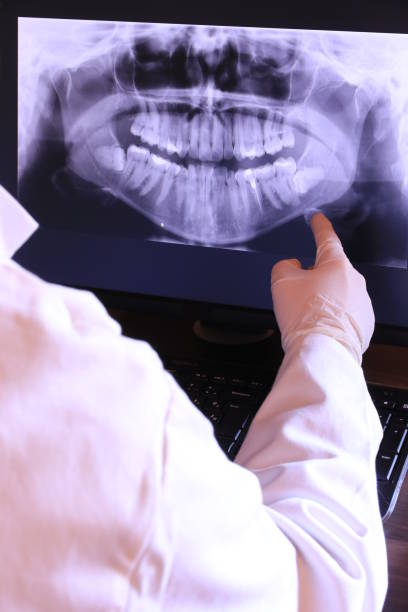 Best Emergency Treatment for Dental Infections or Abscesses in Seaside, OR