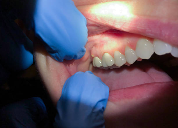 Best Pediatric Emergency Dentist in Seaside, OR