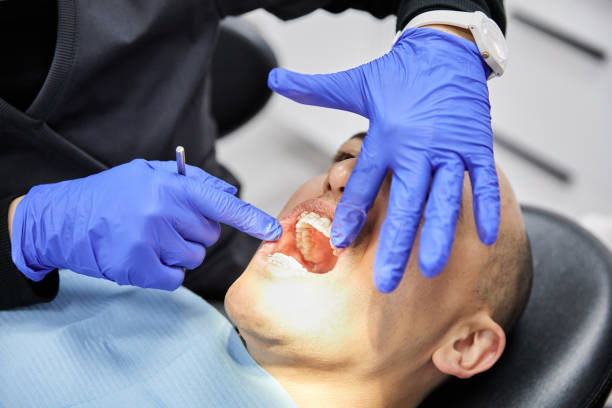 Best Emergency Dental Care for Broken or Chipped Teeth in Seaside, OR
